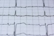 galactic technology and signals