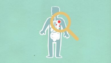 why how kialodenzydaisis kills
